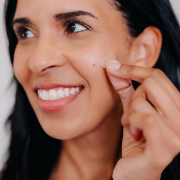 Frownies Pimple Patches