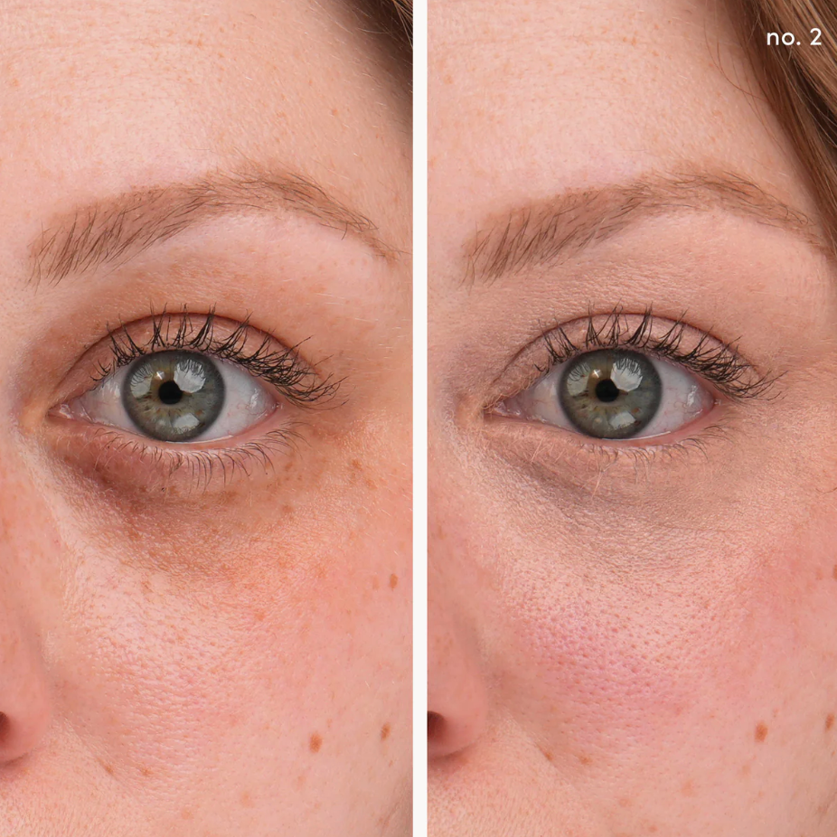 Circle/Delete Concealer (#2)